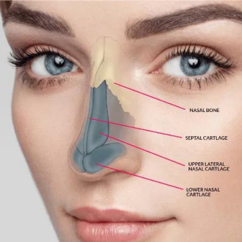Rhinoplasty - Surgical techniques