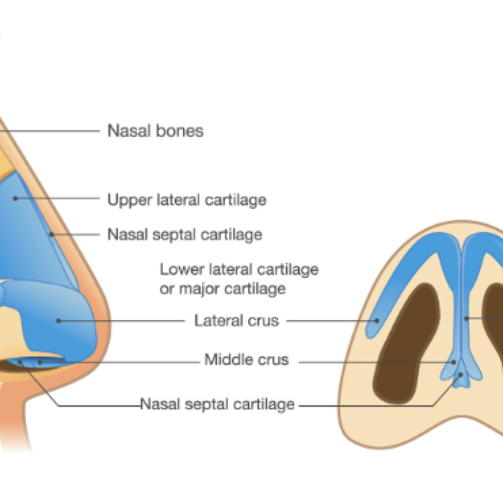 Revision Rhinoplasty