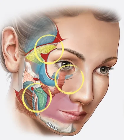 facial-anatomy-illustration Illustration of the facial anatomy: ligaments, spaces, layers and deeper structures